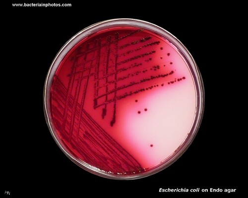 endo lactose positive